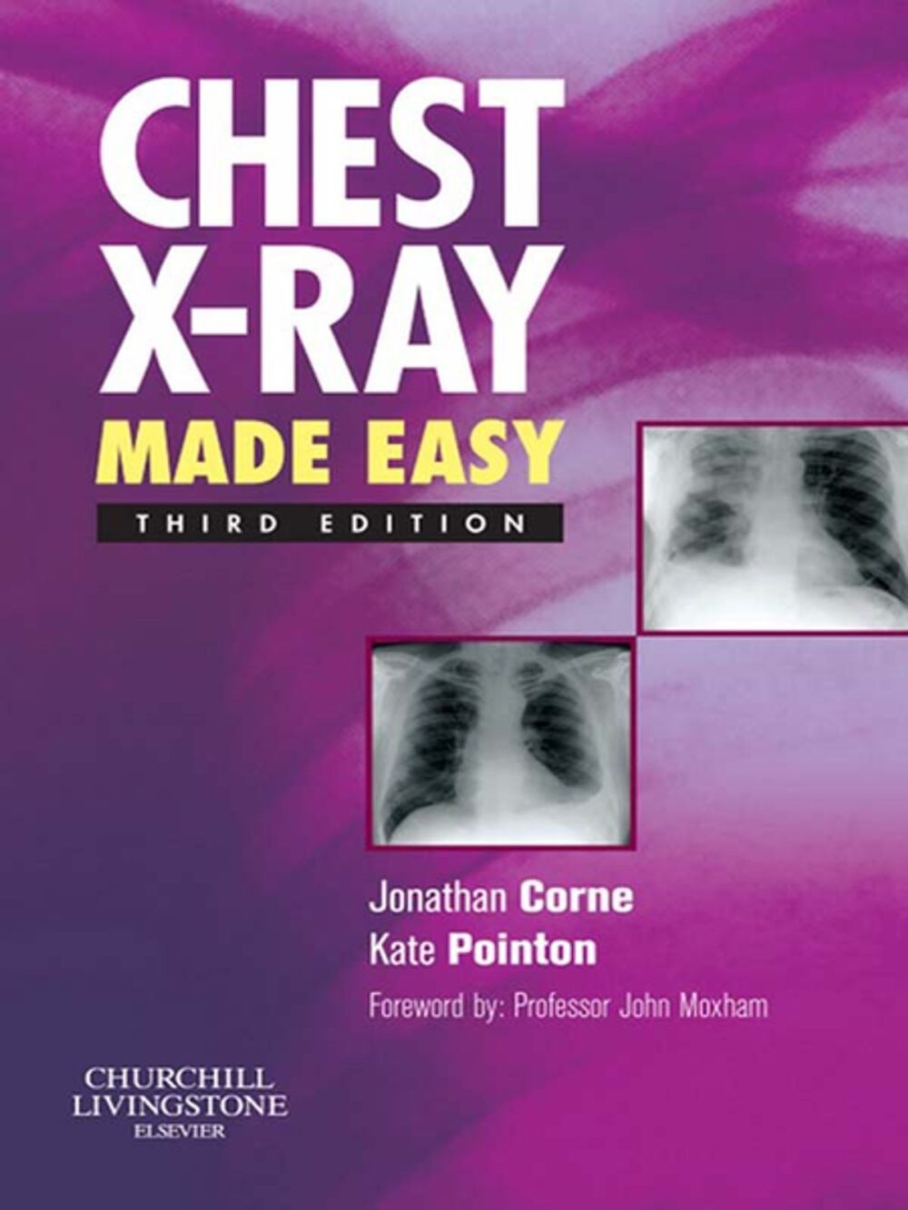Chest X Ray Pharma Medicare