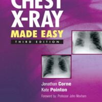 CHEST X-RAY