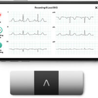 ALIVECOR KARDIAMOBILE ECH 1 LEAD