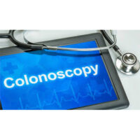COLONOSCOPY