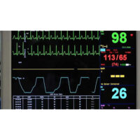VITAL SIGNS MONITOR