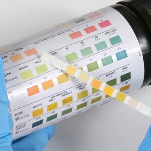 DIAGNOSTICS AND URIBALYSIS