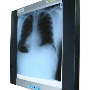 X-RAY VIEWER