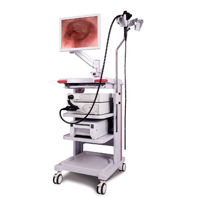 ENDOSCOPY