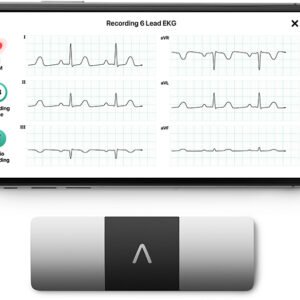 ALIVECOR KARDIAMOBILE ECH 1 LEAD