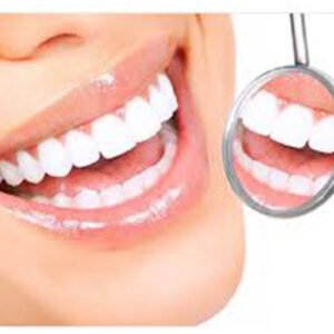 TEETH WHITENING